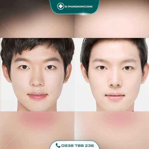 Tạo Khóe Môi Cười Làm Khuôn Mặt Luôn Tươi Tắn Rạng Ngời 28 26 PMC