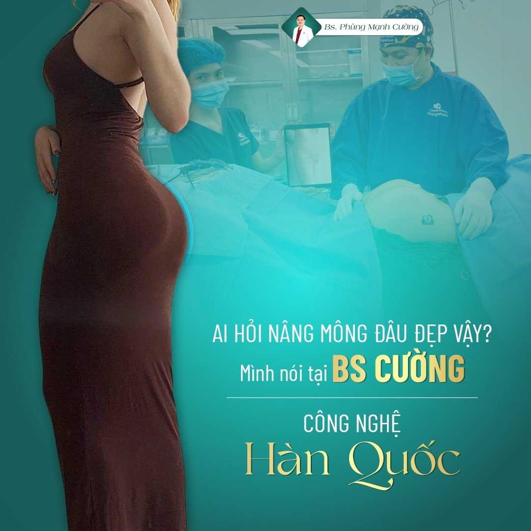 Nâng Mông Bằng Mỡ Tự Thân Cho Vòng 3 Căng Đầy, Mềm Mại 16 Nâng mông bằng mỡ tự thân an toàn khi được thực hiện ở nơi uy tín
