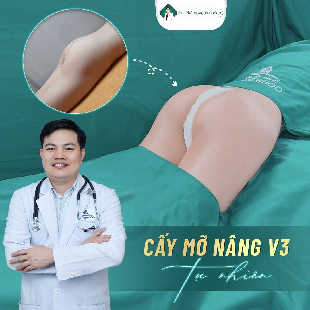 Nâng Mông Bằng Mỡ Tự Thân Cho Vòng 3 Căng Đầy, Mềm Mại 18 Hãy tuân thủ theo hướng dẫn của bác sĩ để có kết quả tốt nhất