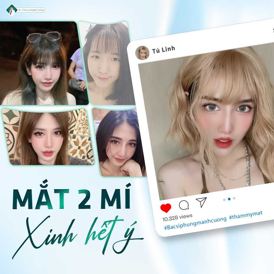 Lựa chọn nơi thực hiện uy tín giúp mí mau hồi phục