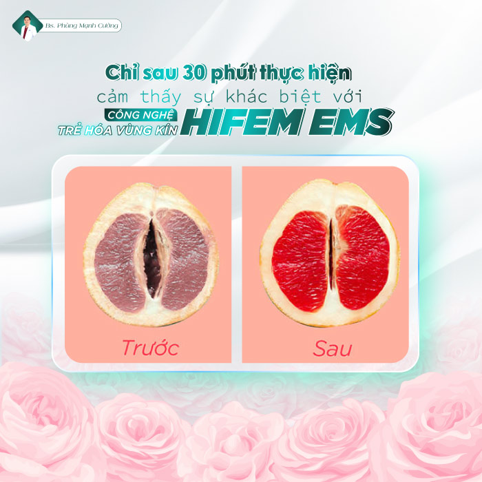 CÔNG NGHỆ TRẺ HÓA VÙNG KÍN HIFEM EMS 19 CÔNG NGHỆ TRẺ HÓA VÙNG KÍN HIFEM EMS