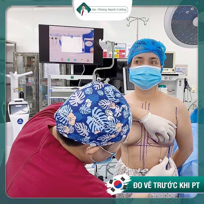 Nâng Ngực Túi Arion Vi Nhám Chuẩn Hàn Tại Việt Nam 23 Bác sĩ Phùng Mạnh Cường sẽ đo vẽ dáng ngực