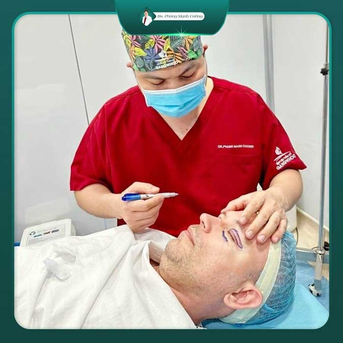 Bác sĩ sẽ đo vẽ phần mí cần phẫu thuật