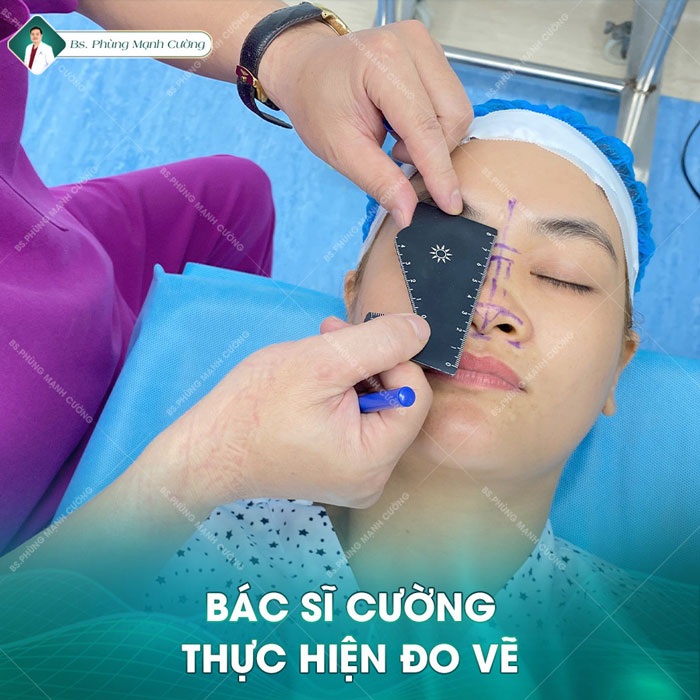 Bác sĩ Phùng Mạnh Cường thực hiện đo vẽ để tạo dáng mũi
