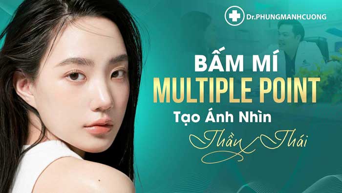 Bấm Mí Multiple Point (Bấm mí đa điểm)