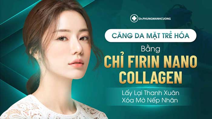 Căng Da Mặt Trẻ Hóa Bằng Chỉ Firin Nano Collagen Lấy Lại Thanh Xuân, Xóa Mờ Nếp Nhăn 20 Căng Da Mặt Trẻ Hóa Bằng Chỉ Firin Nano Collagen Lấy Lại Nét Thanh Xuân Đã Mất.