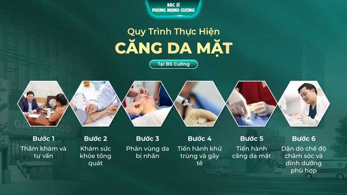 Quy trình căng da mặt bằng chỉ nâng cơ Lifting Collagen tại bác sĩ Phùng Mạnh Cường