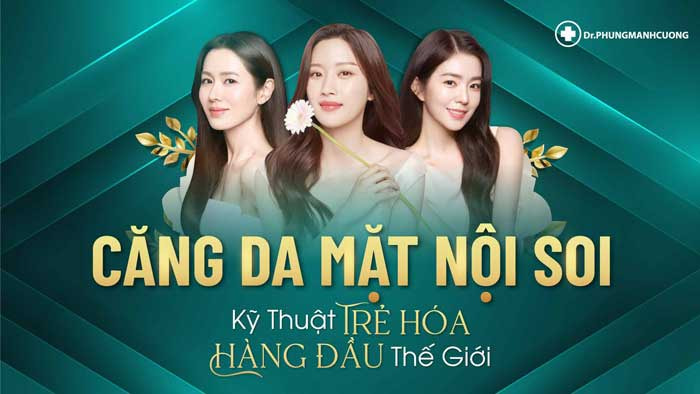 Căng Da Mặt Nội Soi Lấy Lại 5 Đến 10 Năm Thanh Xuân Hiệu Quả