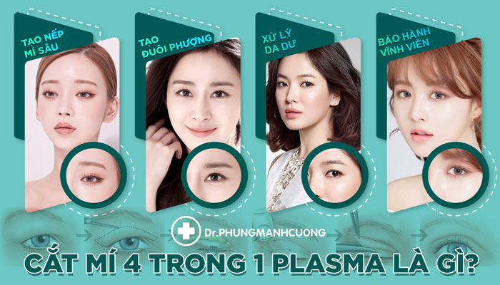 Bác Sĩ Cắt Mí 4 Trong 1 Plasma Cho Đôi Mắt Đẹp "Hoàn Mỹ"