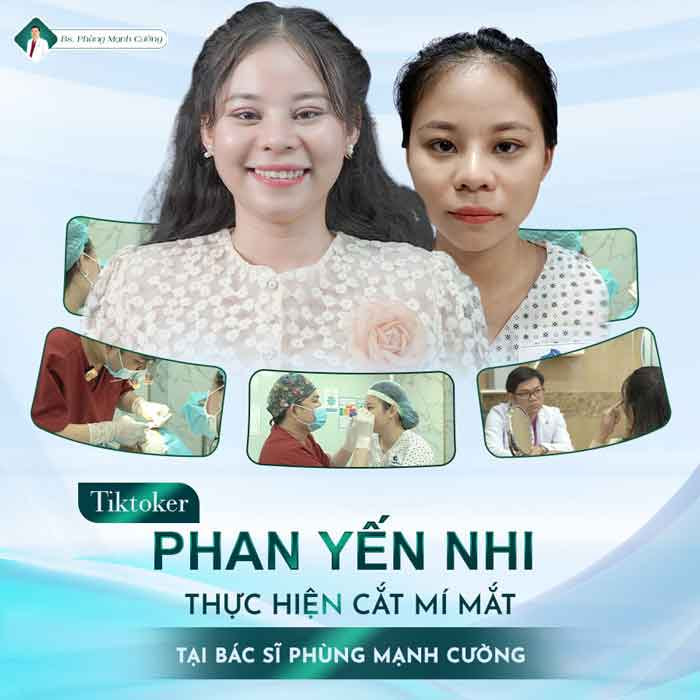 Cắt mí Hàn Quốc Tạo mắt 2 mí to tròn