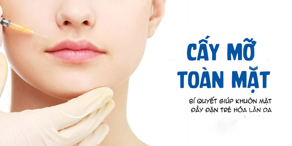 Cấy Mỡ Làm Đầy - Bơm Mỡ Tự Thân