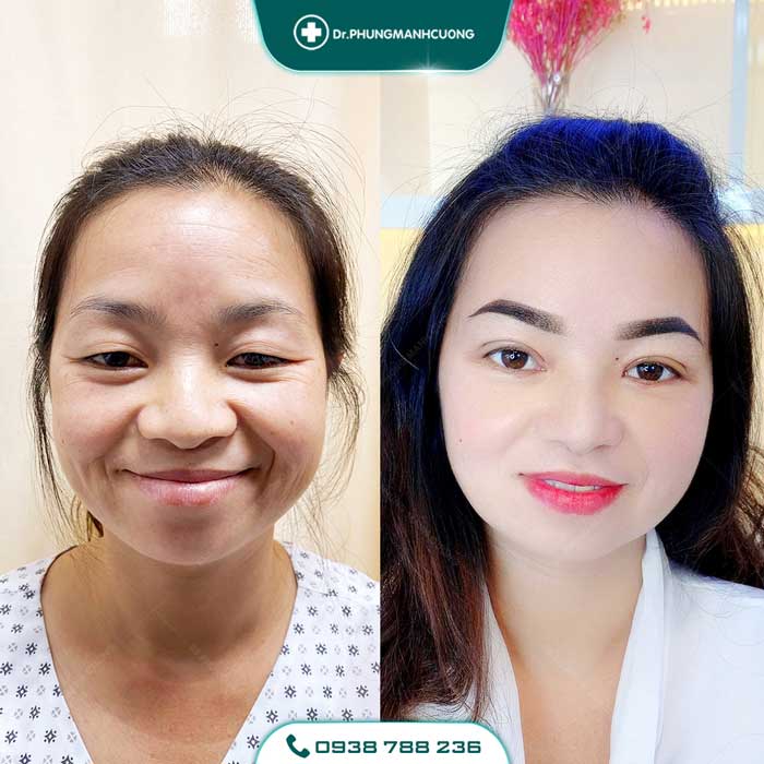 chinh sup mi bam sinh 5