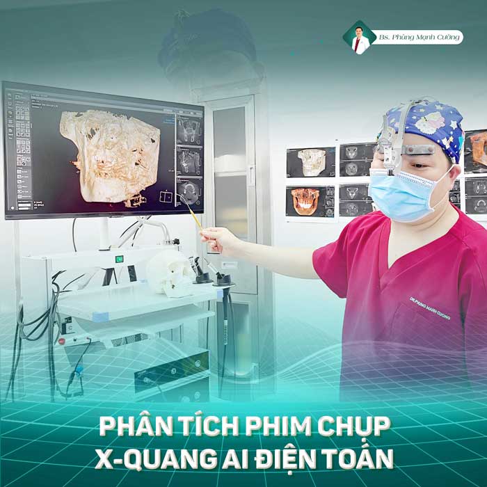 Khách hàng được chụp X-Quang AI điện toán trước khi hạ gò má