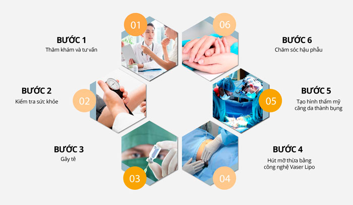 Giảm Béo, Giảm Mỡ Toàn Thân: Vùng Bụng, Bụng Dưới, Bắp Tay