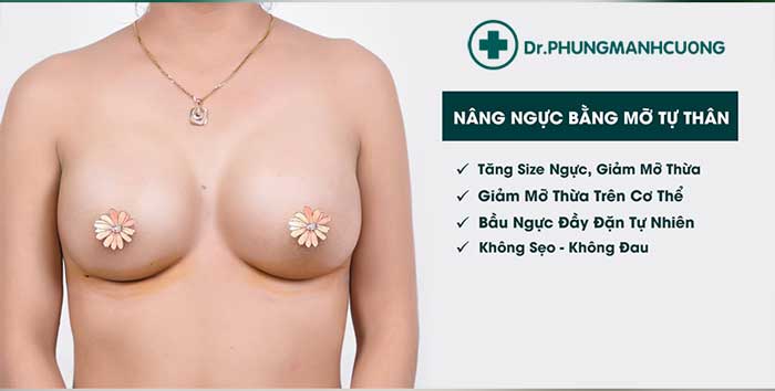 Các đối tượng nên thực hiện nâng ngực bằng mỡ tự thân