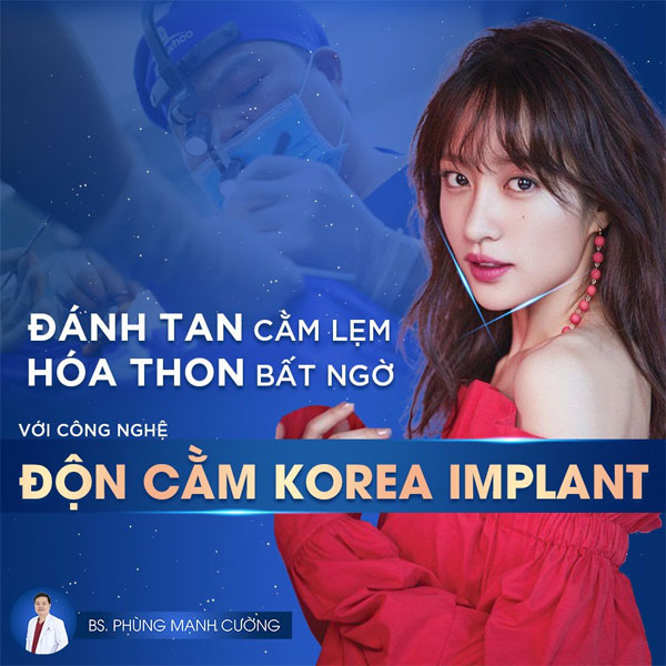 Độn Cằm (Korea Implant) xóa bỏ cằm lẹm