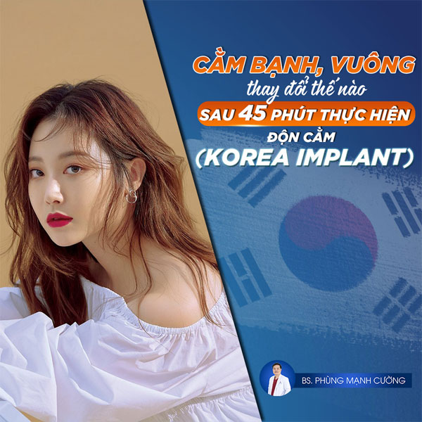 Độn Cằm (Korea Implant) Để Sở Hữu Dáng V Line