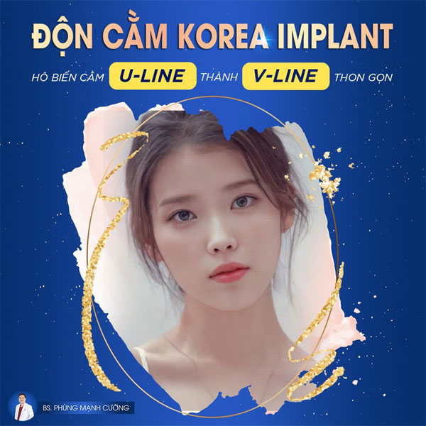 Độn Cằm (Korea Implant) Cho Dáng Cằm Thêm Thon