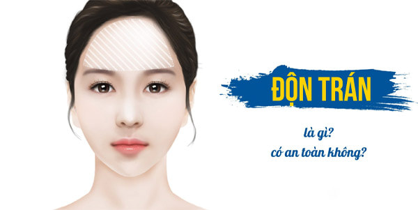 Độn Trán Là Gì?