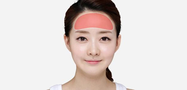 Độn Trán An Toàn Tại Cơ Sở Bác Sĩ Phùng Mạnh Cường