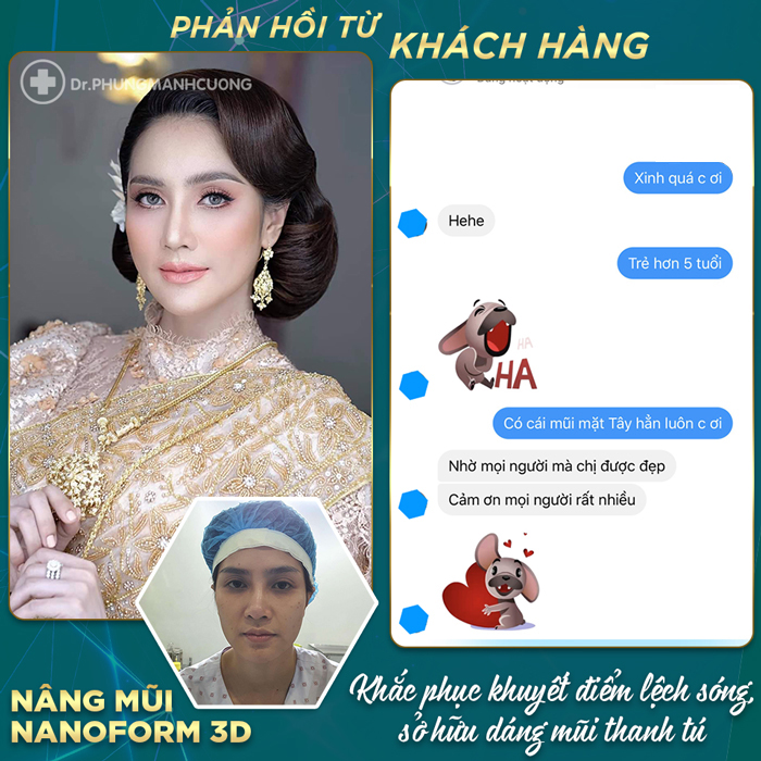 KH kinh ngạc với kết quả nâng mũi do bác sĩ Cường thực hiện