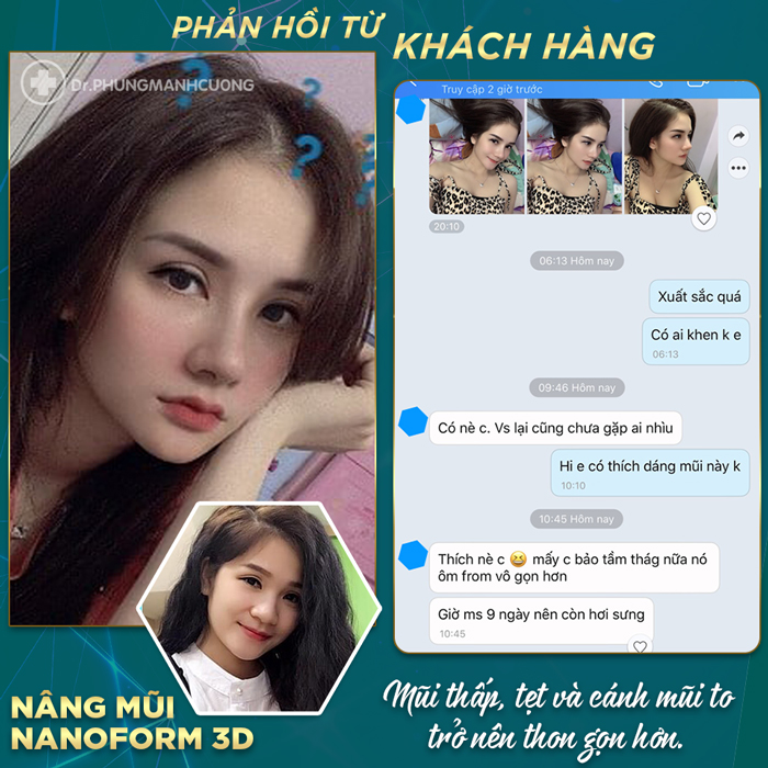 FEEDBACK TỪ KHÁCH HÀNG SAU KHI NÂNG MŨI NANOFORM