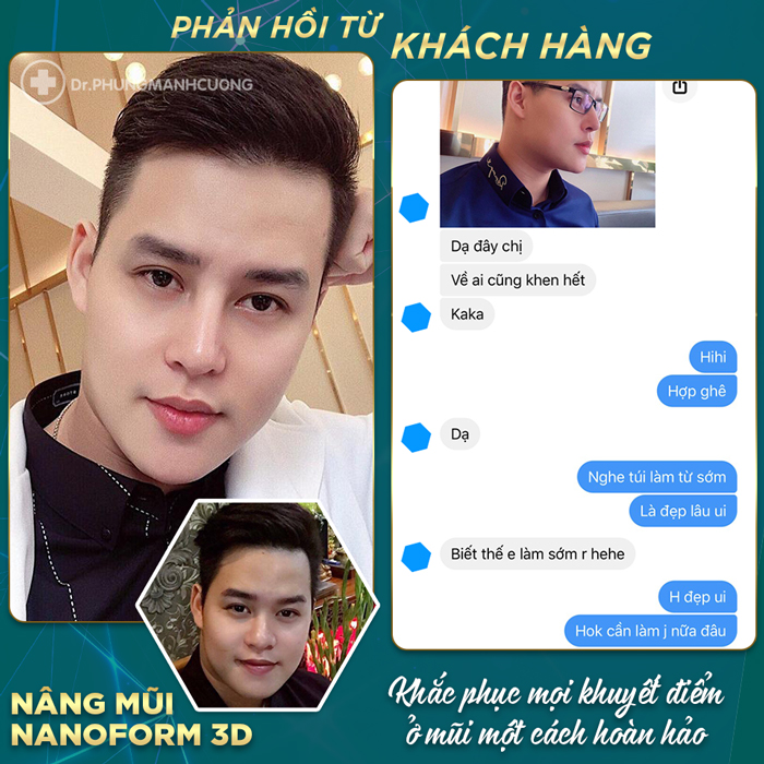 FEEDBACK TỪ KHÁCH HÀNG SAU KHI NÂNG MŨI NANOFORM