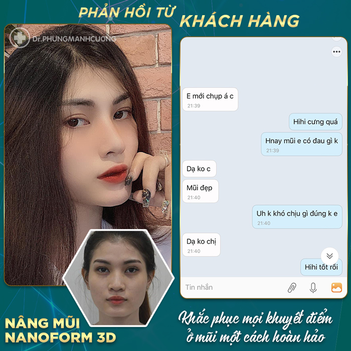 FEEDBACK TỪ KHÁCH HÀNG SAU KHI NÂNG MŨI NANOFORM