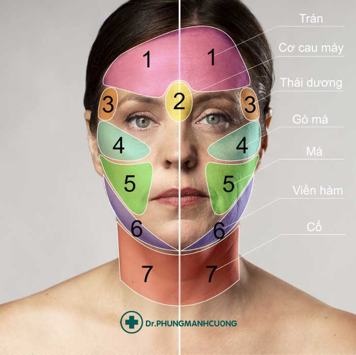 Vị trí căng da mặt Smas