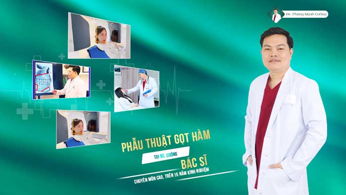 Gọt Hàm Để Dáng Cằm V Line - Thon Gọn Mặt Không Thô Cứng 16 Gọt Hàm V Line Giải Pháp Cho Chiếc Cằm Nhọn Đẹp Hoàn Mỹ