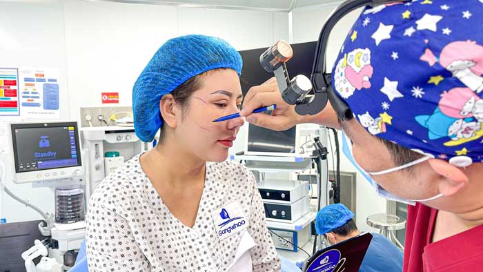 BS Cường thực hiện đo vẽ cho khách hàng thực hiện hạ gò má