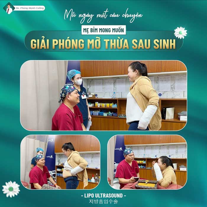 Giảm vọng bụng đáng kể sau khi thực hiện hút mỡ bụng Lipo Ultrasound