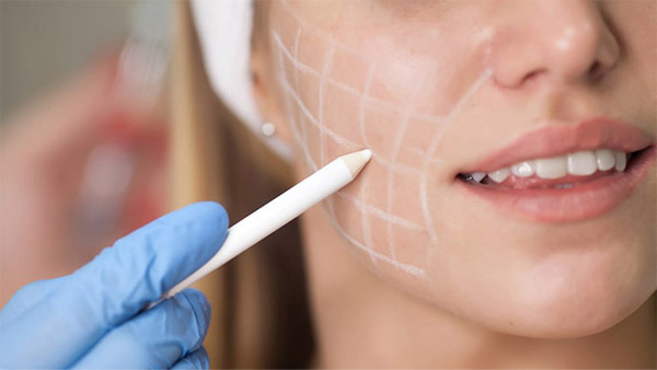 Hút Mỡ Mặt, Hút Mỡ Má Cho Khuôn Mặt Thon Gọn V Line 12 Hút Mỡ Mặt, Hút Mỡ Má Cho Khuôn Mặt Thon Gọn V Line