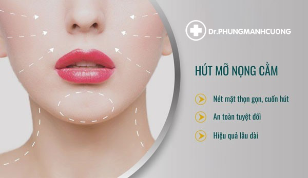 Hút Mỡ Nọng Cằm - Lấy Mỡ Cho Khuôn Mặt Thanh Tú 14 Hút Mỡ Nọng Cằm - Phương pháp giảm mỡ hiệu quả