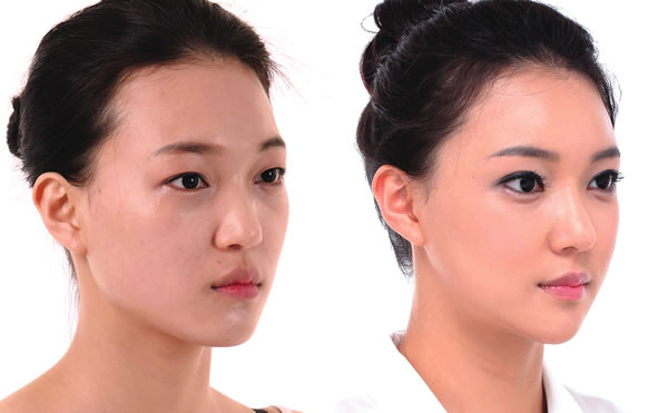 Hướng Dẫn Chăm Sóc Sau Khi Thực Hiện Dịch Vụ