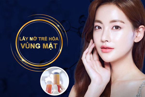 Cấy Mỡ Làm Đầy Và Lấy Mỡ Trẻ Hóa Vùng Mặt