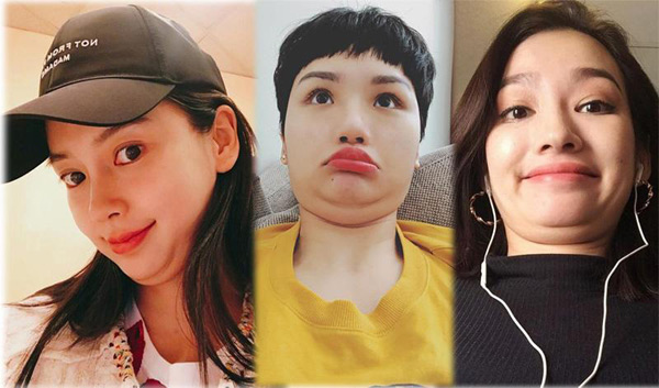 Lipo Nội Soi Nọng Cằm Giải Quyết Cằm Ngấn Mỡ