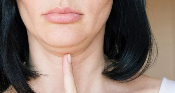 Quy Trình Lipo Nội Soi Nọng Cằm