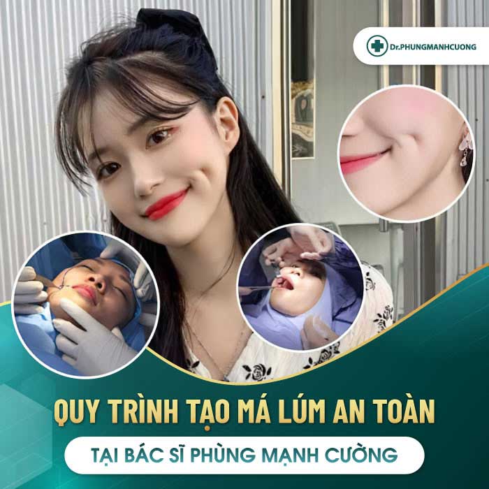 Quy trình tạo má lúm an toàn tại BS Phùng Mạnh Cường