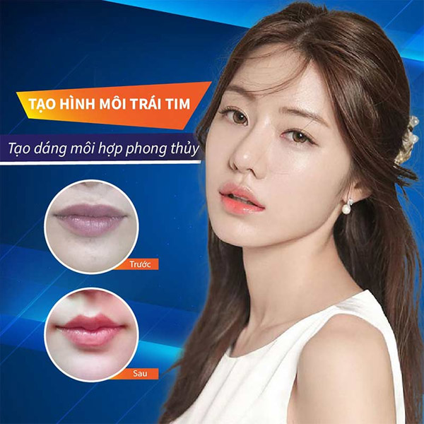 Hóa Môi Thường Thành Môi Trái Tim