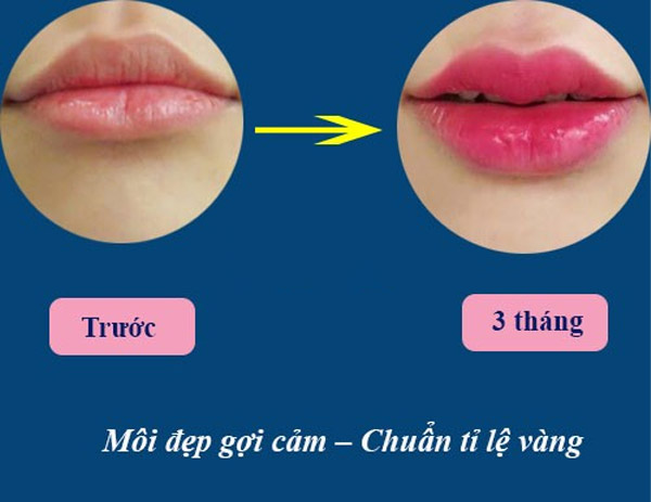 Môi Trái Tim - Dáng Môi Đẹp Nhất