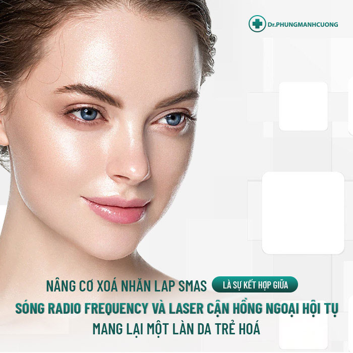 Nâng Cơ Xóa Nhăn (Lap Smas) Công Nghệ Trẻ Hóa Da Hiệu Quả 13 Nếu bạn mong muốn tìm 1 lại tuổi thanh xuân nhưng sợ dao kéo, thì đây là lựa chọn an toàn