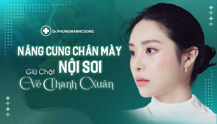 Nâng Cung Chân Mày Nội Soi Đánh Tan Nỗi Lo Sụp Mí, Trễ Mí