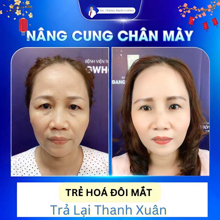 nang cung chan may 2