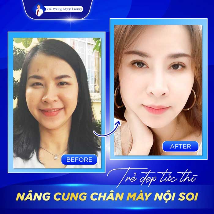 nang cung chan may 3