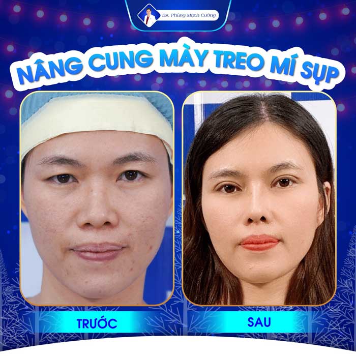 nang cung chan may 4