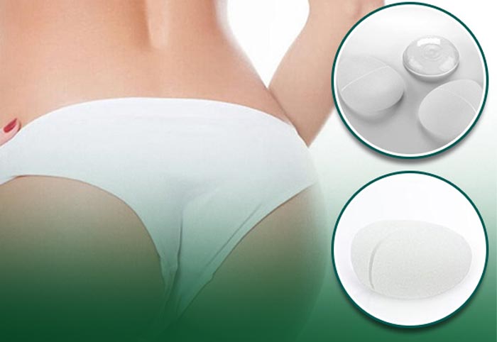 Nâng Mông Nội Soi Bằng Túi Ergonomix Khắc Phục Vòng 3 Chảy Xệ 7 Nâng Mông Nội Soi Bằng Túi Ergonomix Khắc Phục Vòng 3 Chảy Xệ