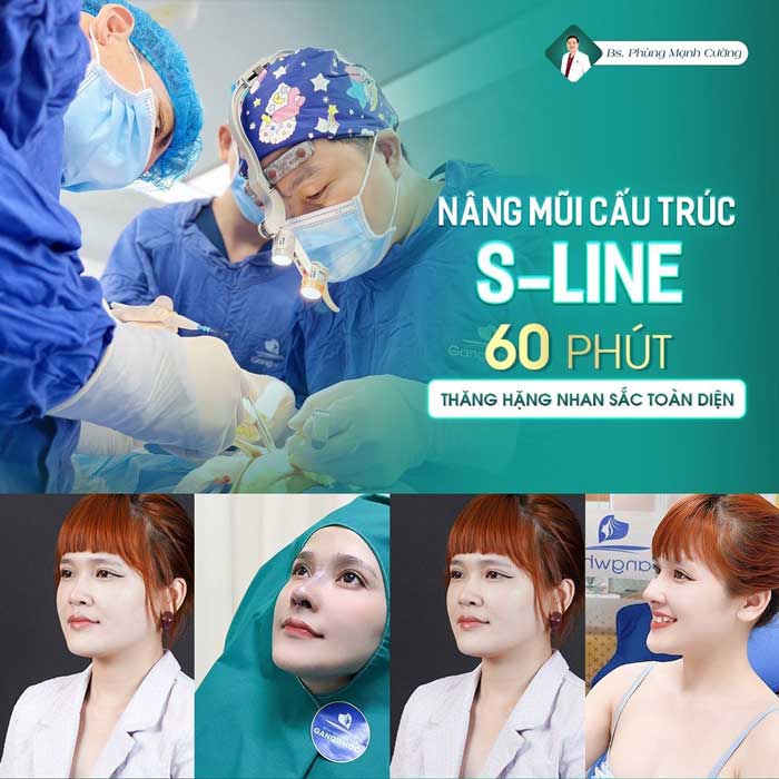 Nâng mũi cấu trúc tạo dáng S Line thời thượng