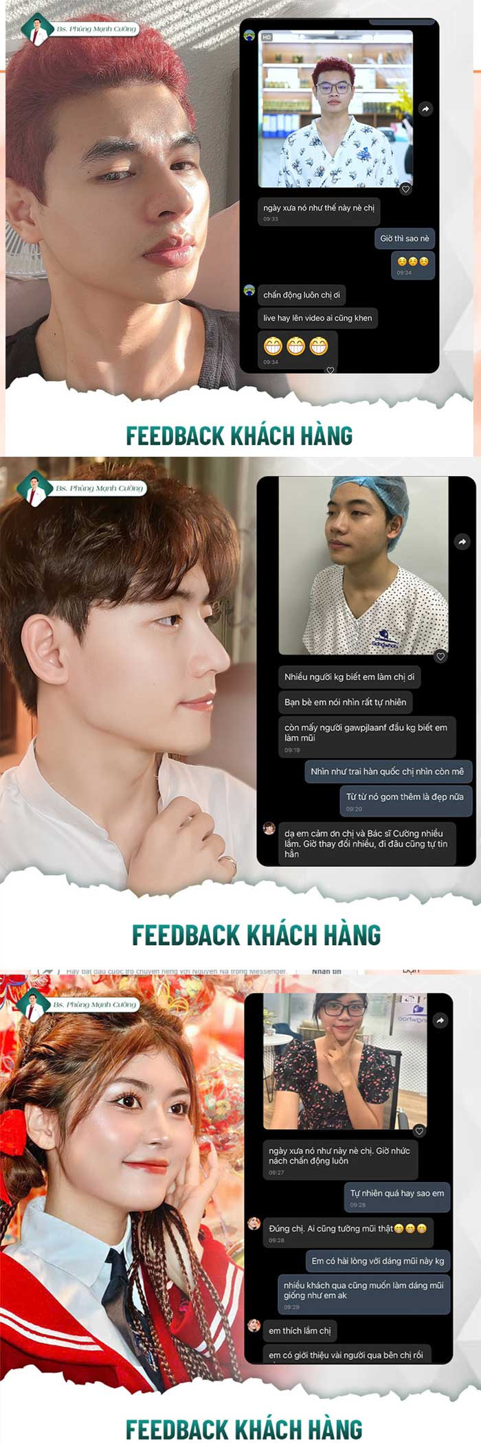 Khách hàng feedback bác sĩ phùng mạnh cường nâng mũi cấu trúc