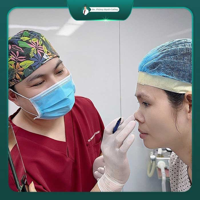 Bác sĩ Cường sẽ đo vẽ dáng mũi cho khách hàng